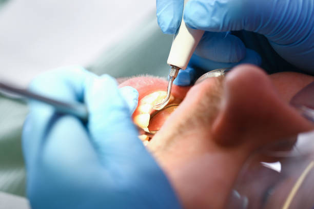 Best Urgent Tooth Repair  in Cozad, NE